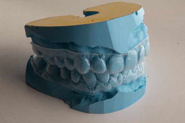 Dental mold with clear orthodontic aligner, symbolizing patient smile transformation in NYC orthodontic case studies.